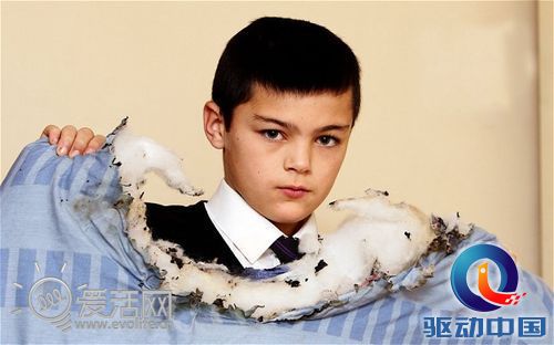 黑莓手机自燃烧伤英国11岁男孩 家长要求RIM召回手机产品