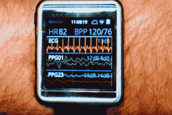 samsunghealth_heartbeat-100276880-large.gif