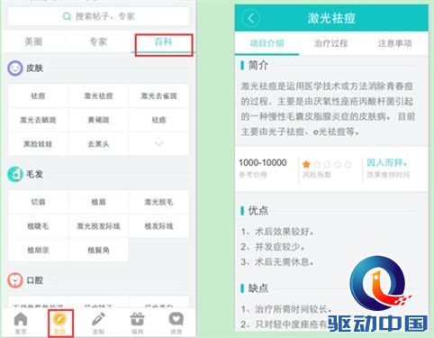 更美APP推出整形百科 哪里不懂学哪里 