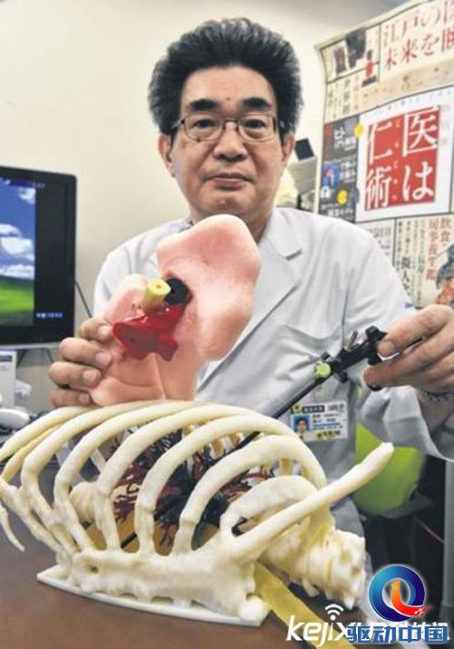 日本研制世界最细人工血管 直径仅0.6毫米
