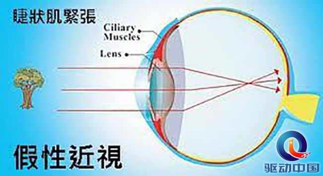 涨姿势了，ivvi k5裸眼3D竟意外改善了假性近视!_驱动中国