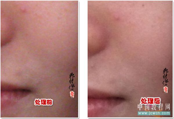 Photoshop后期教程：去除人物皮肤红、黄色斑及美化