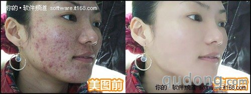一键深度磨皮