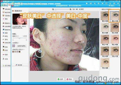 美白皮肤