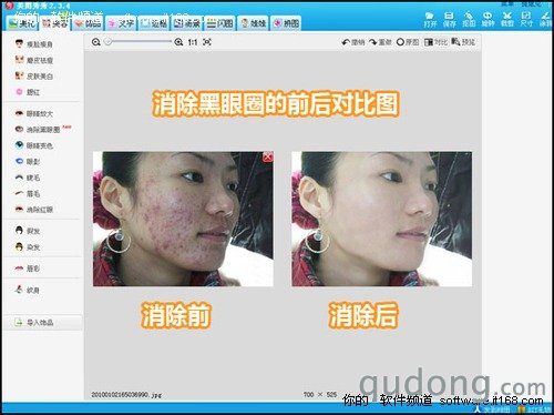 美白皮肤