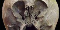 墨西哥奇怪头骨之谜 是外星人还是其他物种？