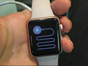又有果粉被烧伤！Apple Watch 怎么了？