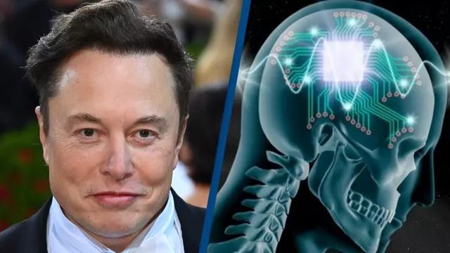 马斯克旗下脑机接口公司今年将进行首例人体试验